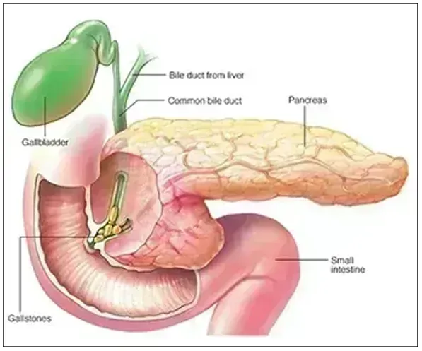 Pancreatic Diseases