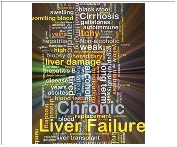 liver failure