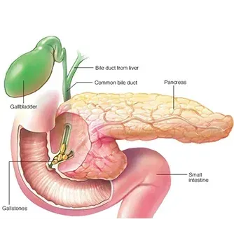 Pancreatic Diseases